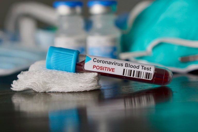 Brookside Health Center: Pruebas COVID-19 sin cita  en Jamaica Plain
