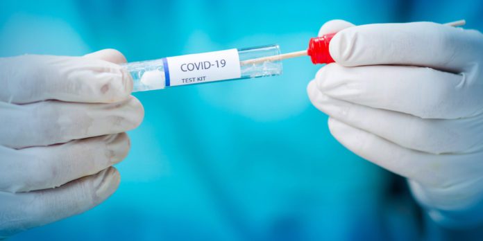 COVID TEST