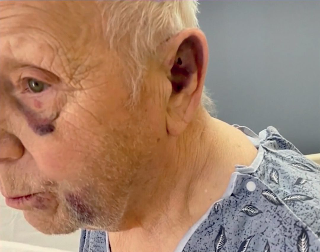 Policía pide ayuda para identificar agresores de anciano 2 2 Anciano atacado1