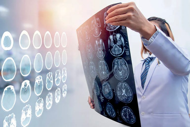 El Traumatismo Cerebral (TBI por sus siglas en inglés)