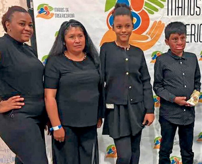 “Manos de Misericordia”, ayudando a niños quemados