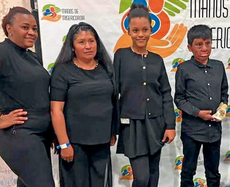“Manos de Misericordia”, ayudando a niños quemados