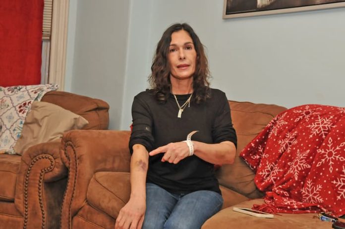 Milagros Rosado Fernández muestra signos de su enfermedad.